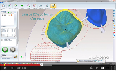 Usinage contre-dépouille automatique sur charlydental 4 axes (vidéo)