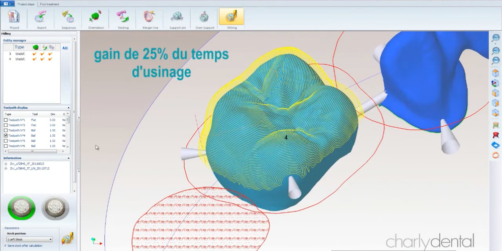 logiciel de fraisage prothèse dentaire