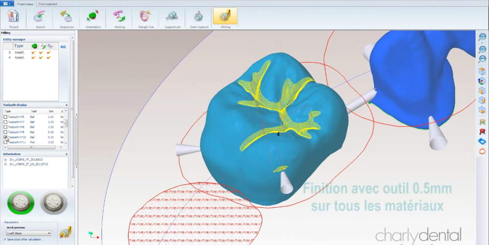 modélisation par logiciel de prothèse dentaire pour fraisage CNC